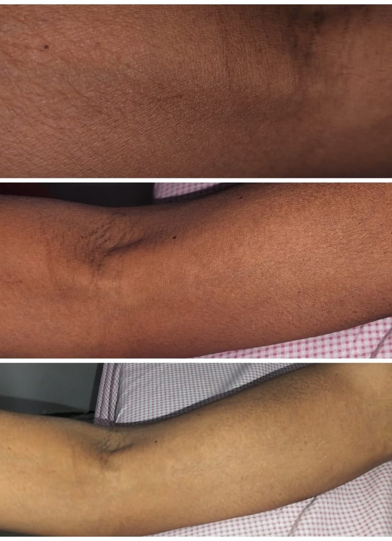 Close-ups of the cording along the inner arm.
