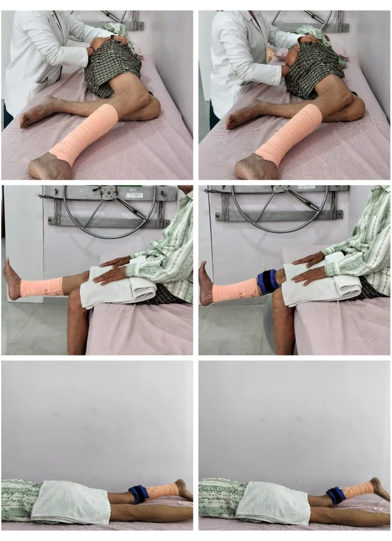 Leg-strengthening exercises with ankle weights, lying and sitting.