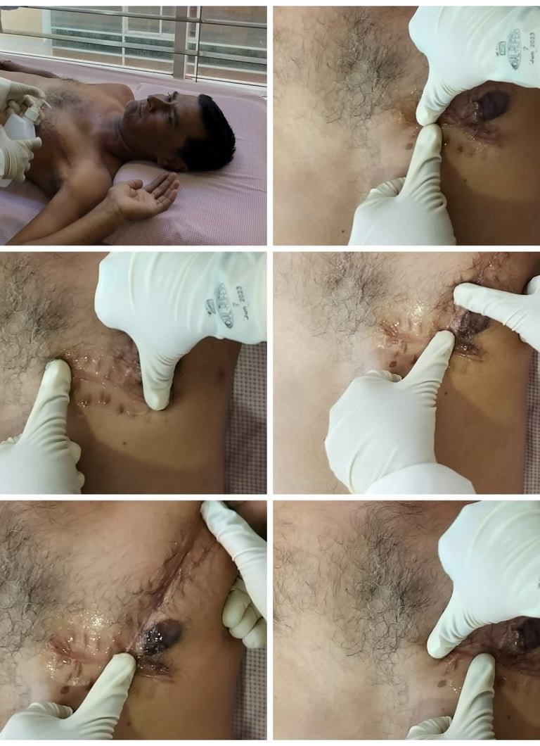 Hands-on scar work around the surgical site.