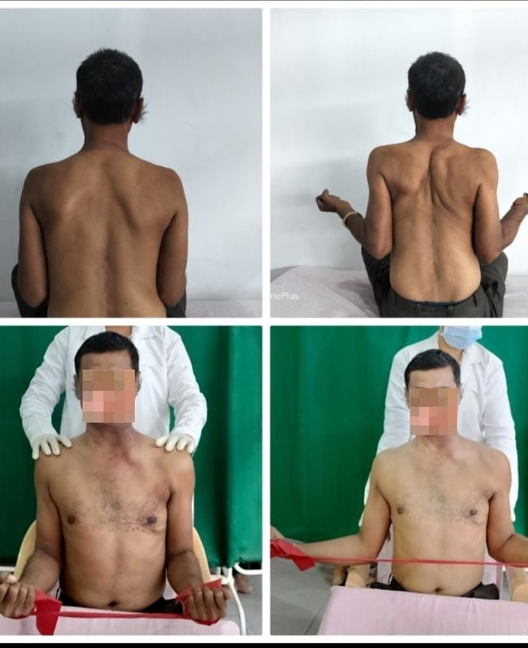 Posture from behind, and resistance-band exercises.
