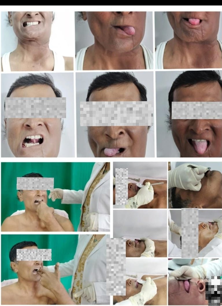 Mouth, tongue and jaw exercises.